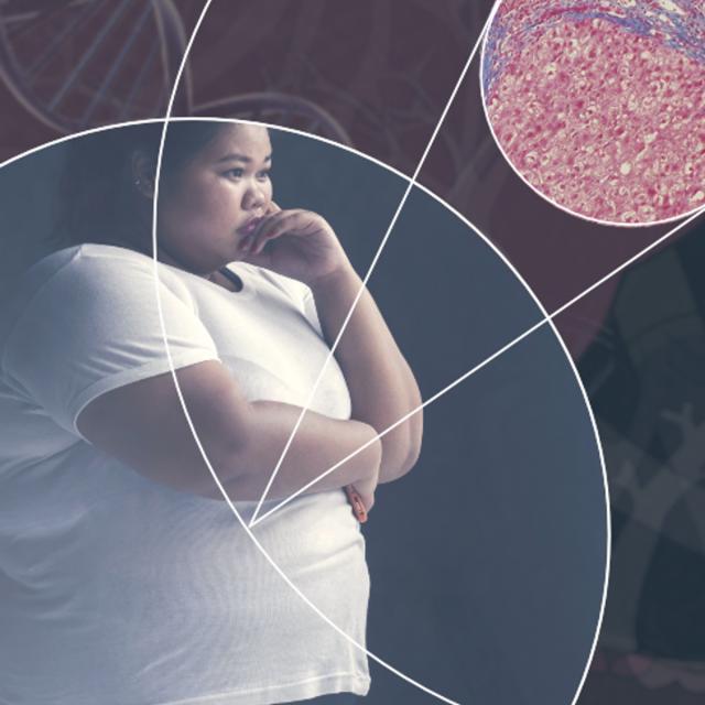 Non-Alcoholic Fatty Liver Disease – The Essentials (Coursera)