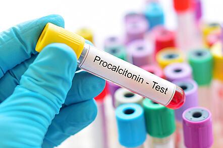 Procalcitonin: PCT as a Biomarker for Antimicrobial Stewardship (FutureLearn)