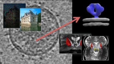 Image and video processing: From Mars to Hollywood with a stop at the hospital (Coursera)
