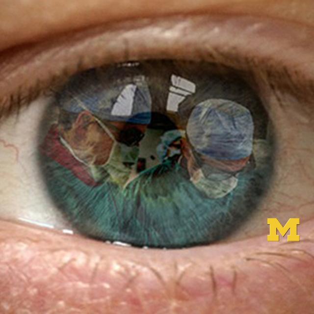 Introduction to Cataract Surgery (Coursera)