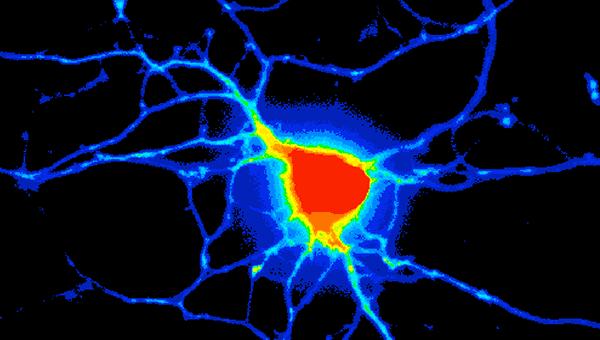 Integrated Analysis in Systems Biology (Coursera)