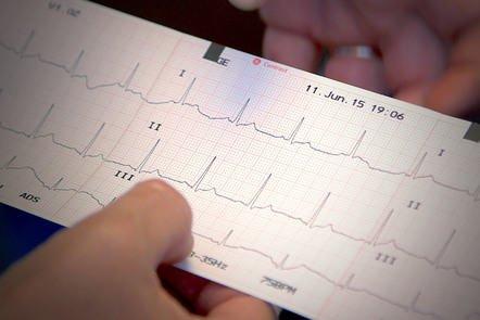 ECG Assessment: an Introduction for Healthcare Providers (FutureLearn)