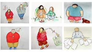 Chirurgie De L Obésité Fun Mooc List