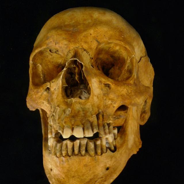 Osteoarchaeology: The Truth in Our Bones (Coursera)