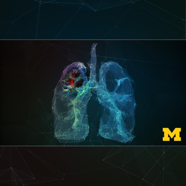 Thoracic Oncology (Coursera)