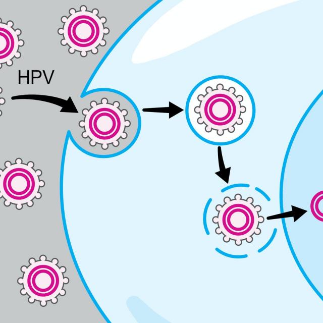 HPV-Associated Oral and Throat Cancer: What You Need to Know (Coursera)