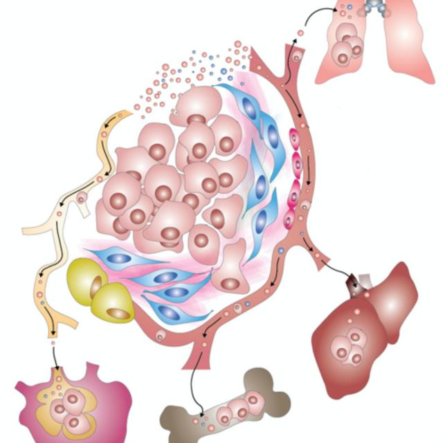 Extracellular Vesicles in Health and Disease (Coursera)